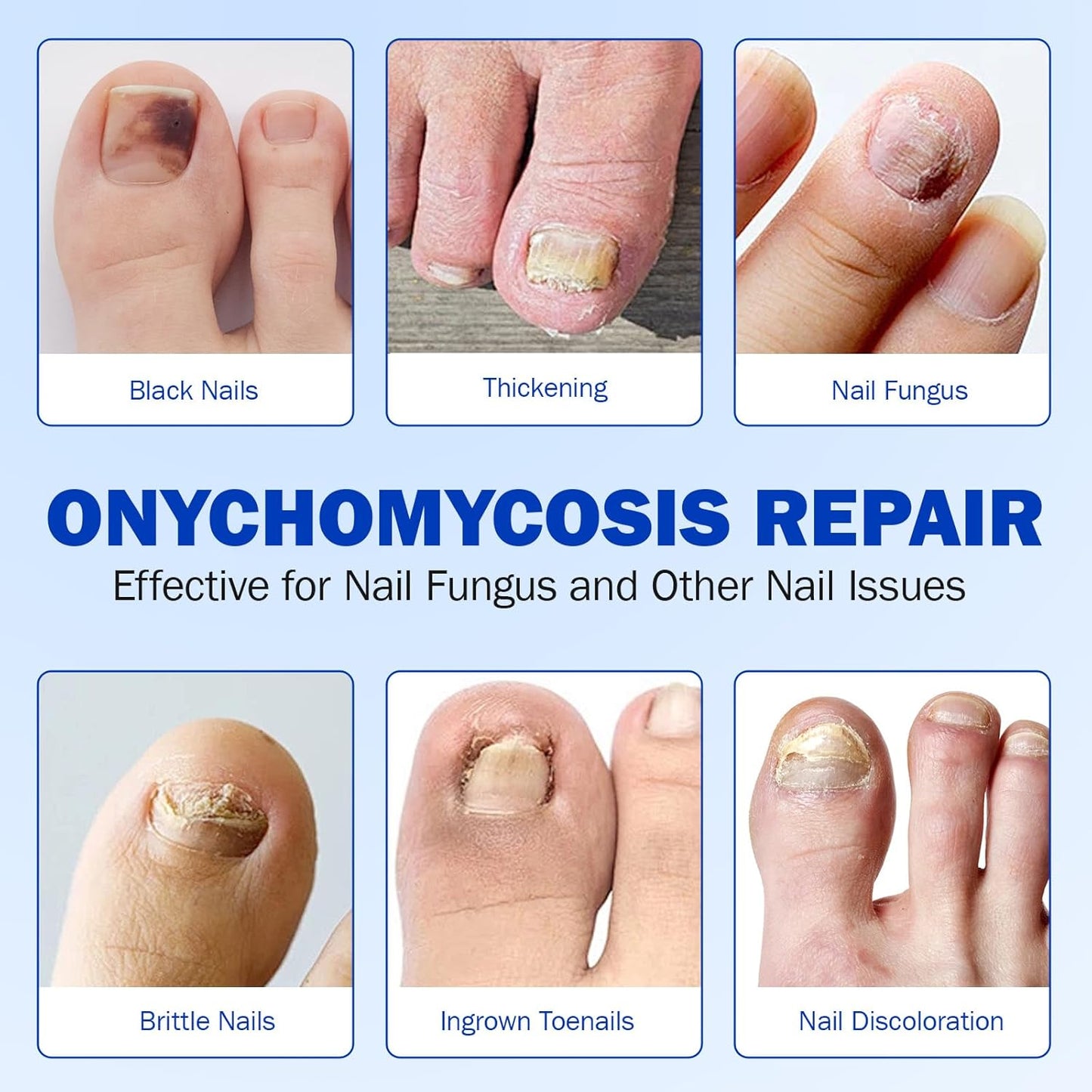 21 PCS Nail Patches ,Toenail Treatment Patch Extra Strength 8-Hour ,Nail Repair Patches,Nail Repair for Restores Damaged Nails and Appearance of Discolored,Overnight Renewal for Men and Women(2pack)