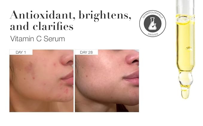 Infinitek Paris Vitamin C Face Serum - Hydrating and Brightening Antioxidant Skincare with Green Tea and Ginseng - Premium Vitamin C Facial Serum with Hyaluronic Acid for Radiant Skin and Anti Aging