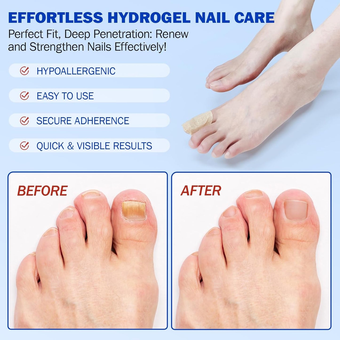 21 PCS Nail Patches ，Toenail Treatment Patch Extra Strength 8-Hour ，Nail Repair Patches,Nail Repair for Restores Damaged Nails and Appearance of Discolored，Overnight Renewal for Men and Women（2pack）