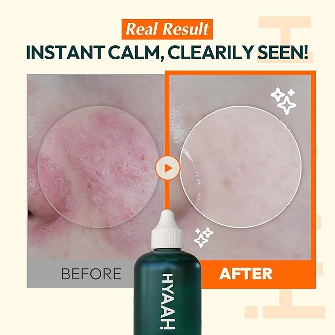 Licorice First Essence - Korean Hydrating Toner - Licorice Extract, Hyaluronic Acid and Allantoin - Soothing for Sensitive Skin - Alcohol Free for Sensitive Skin, 6.76 fl.oz