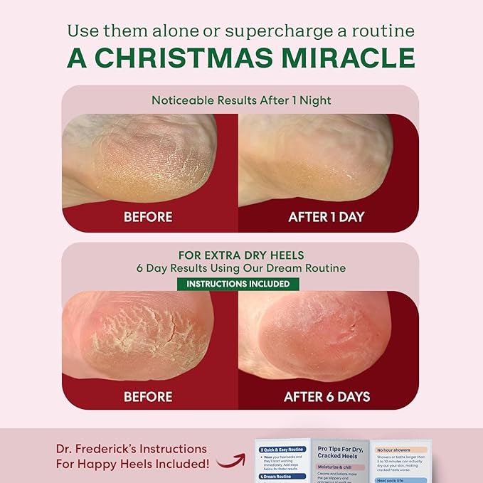 Dr. Frederick's Holiday Fuzzy Heel Socks - 3 Pairs - Christmas Self-Care Gift - Cozy Gel-Lined Sleep Socks - Spa Pampering Gift Set - Soothe Dry, Cracked Feet Overnight - Holiday Special Editions