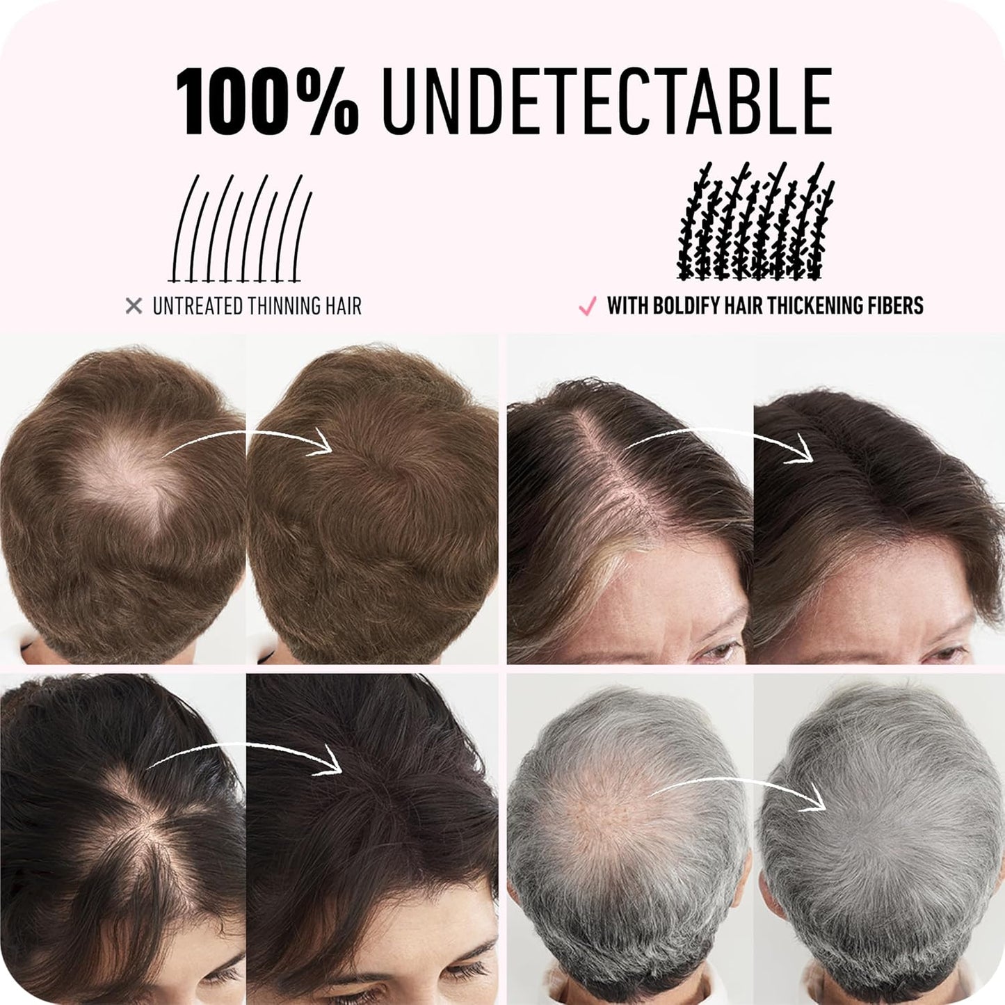 BOLDIFY Hair Fibers (28g) - Fill In Thinning and Fine Hair for an Instantly Fuller, Thicker Look - 14 Shades for Women & Men - Dark Auburn