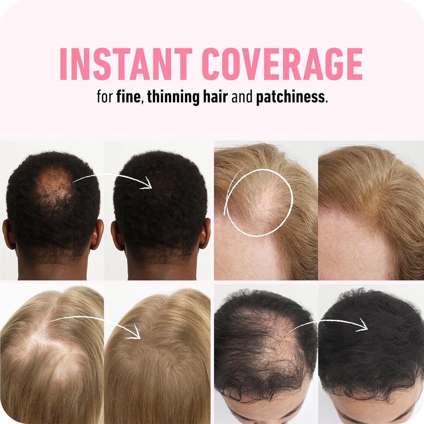 BOLDIFY Hair Fibers (28g) - Fill In Thinning and Fine Hair for an Instantly Fuller, Thicker Look - 14 Shades for Women & Men - Dark Blonde