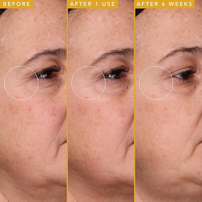 Farmacy Hyaluronic Acid Serum for Face - Filling Good Anti Aging Skin Care + Hydrating Face Serum - Plumping + Smoothing Wrinkle Serum to Visibly Firm Skin for a Youthful Complexion (30ml)