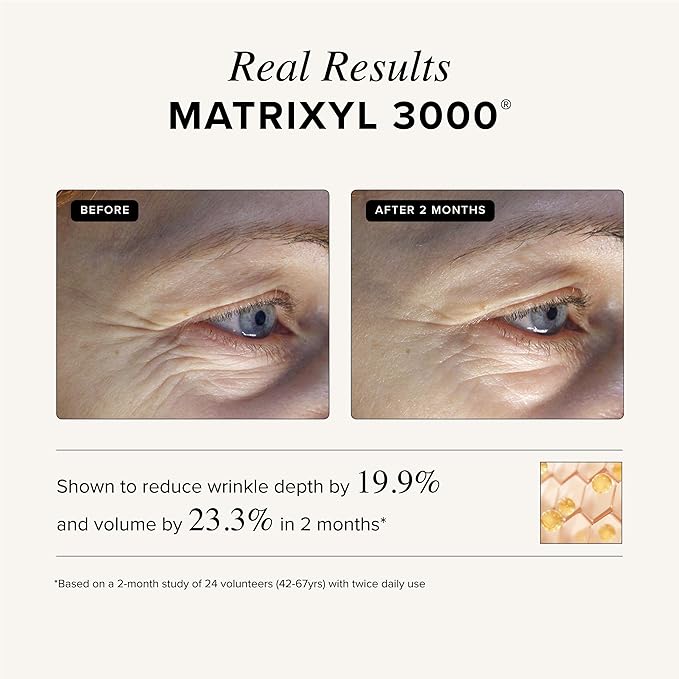 Asterwood Triple Repair Matrixyl 3000 + Argireline + Hyaluronic Acid + Vitamin C Serum for Face - Anti-Aging, Collagen Boosting, Hydrating - Fragrance-Free - 1 Fl Oz